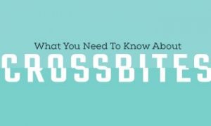 What You Need To Know About Crossbites