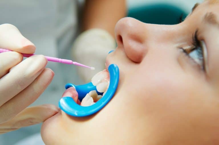 Sealants Protect Your Child’s Teeth